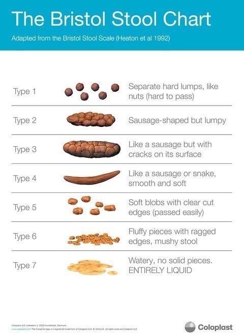 The Bristol Stool Chart